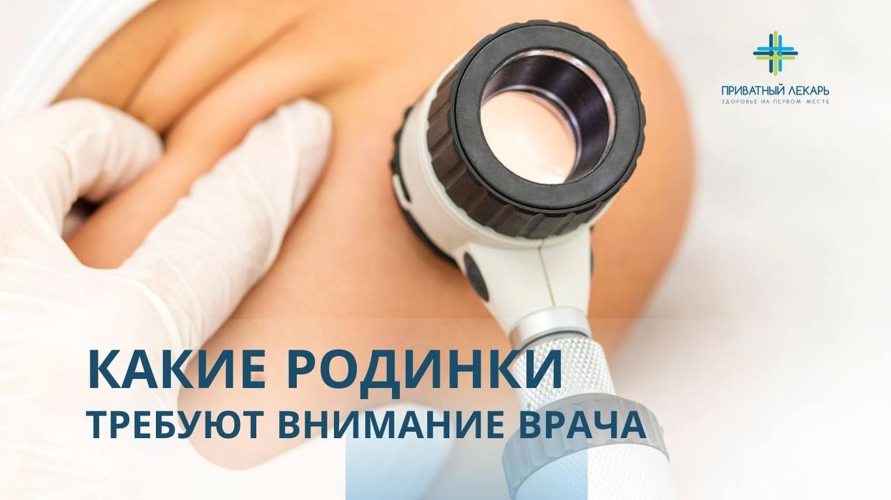 Какие родинки требуют внимания врача